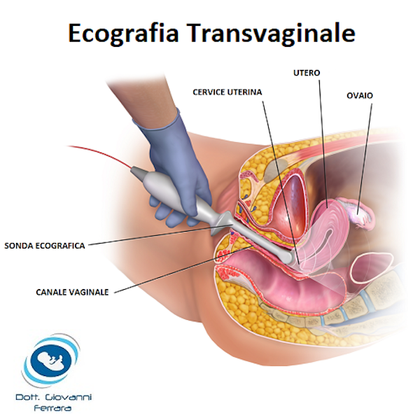 Visita ginecologica con Pap test e Brush endocervicale