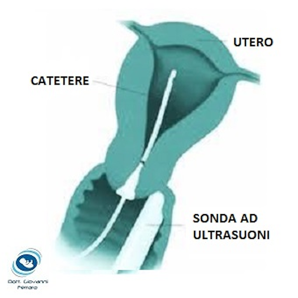 Visita ginecologica con Pap test e Brush endocervicale