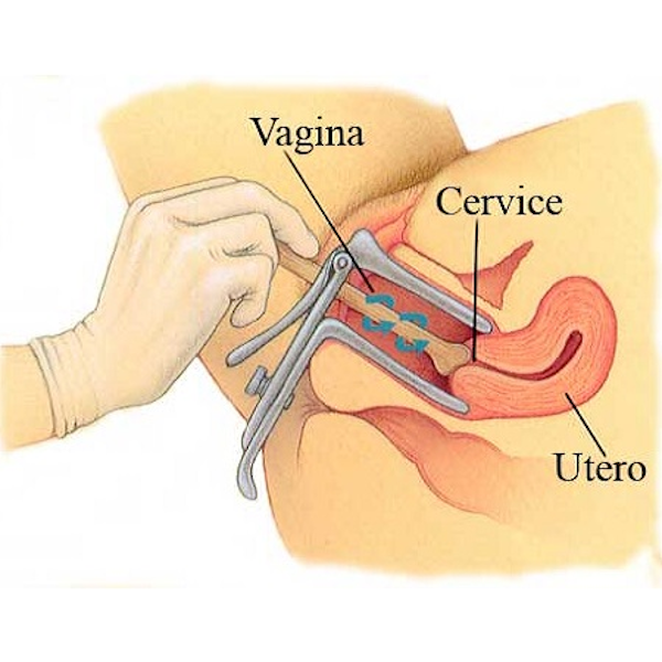 Visita ginecologica con Pap test e Brush endocervicale